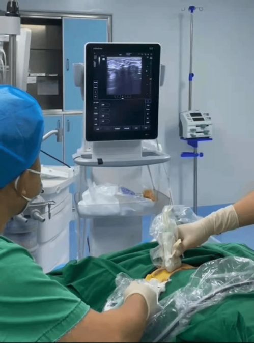 湘乡市首台乳腺病灶旋切式活检系统在中医医院开展乳腺肿块微创切除