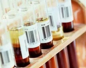 孟买血 孟买血型的分布