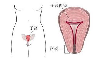 子宫内膜厚是什么原因引起的？内膜厚是什么原因造成的怎么办