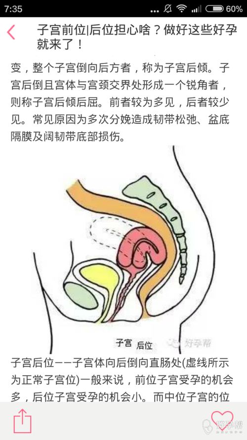 有没有后位子宫做试管成功的啊