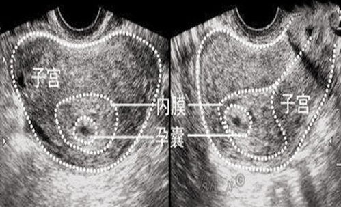 孕期第一次产检中,这三个指标合格,恭喜你,说明胎儿发育健康