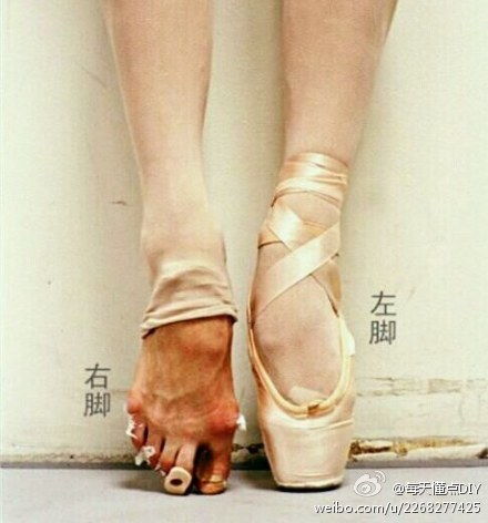 芭蕾鞋里的血色