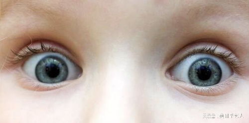 眼球萎缩但角膜外凸可以定制义眼吗