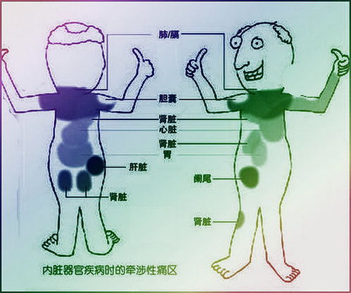 后背疼痛位置图详解 身体各个器官疼痛位置图片 