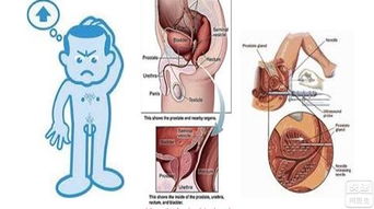 前列腺炎手术治疗的方法(前列腺炎手术效果如何)