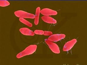 肉毒杆菌在哪些食物中产生的，什么是肉毒杆菌