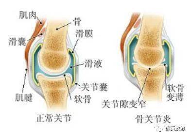 骨与关节病变的基本X线征象