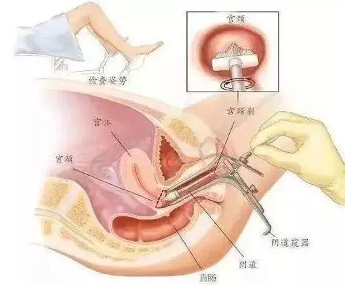 你说妇科检查不痛 行,谁哭谁矫情