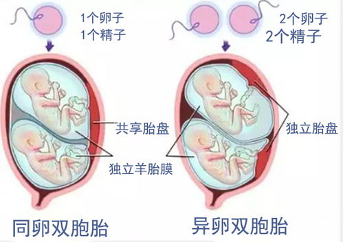 异卵双胞胎25周减胎风险大吗(异卵双胞胎15周在肚子图片)