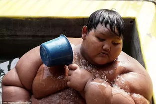 世界最胖男孩 刚10岁已有384斤 