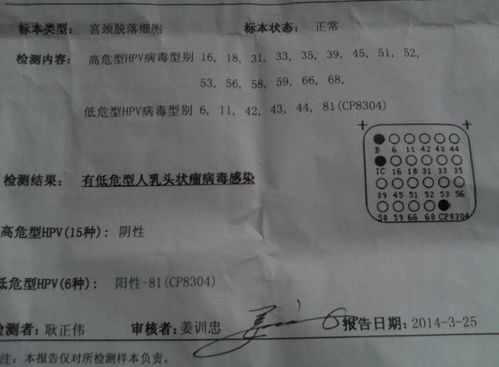 22岁女孩恋爱半年,感染HPV,医生 4种男人碰不得