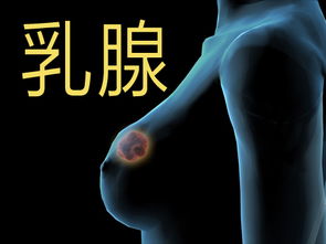 乳腺囊性增生，什么是乳腺囊性增生症