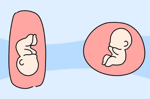 胎动看男女，从胎动可以看出宝宝性别吗