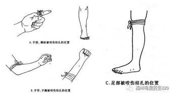 男子凌晨打鱼回来,突然全身冒汗 四肢无力,左脚的牙印是 凶手 留的