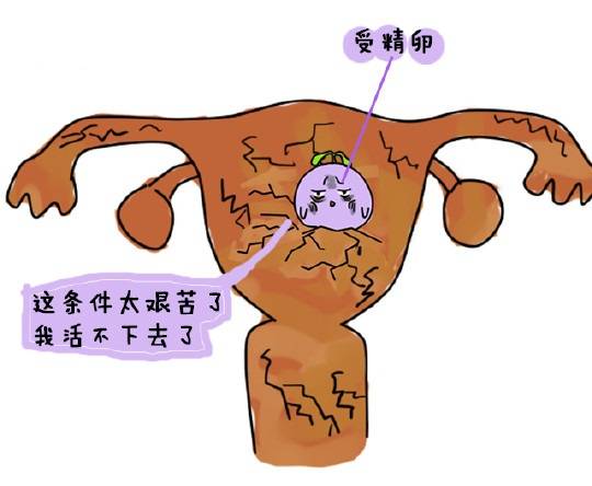 原创子宫内膜薄会导致不孕？如何增加内膜厚度？一文告知答案！
