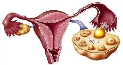 看看 卵巢保养的好处,如何保养子宫和卵巢,不敢相信