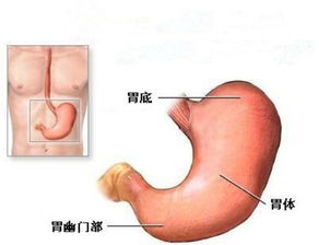 糖尿病患者，胃癌中期，医生建议胃全切，可行吗