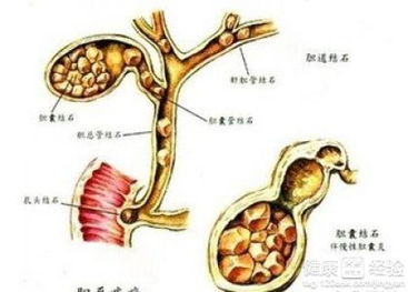 脑囊肿最佳治疗方法(脑囊肿的症状10大前兆)