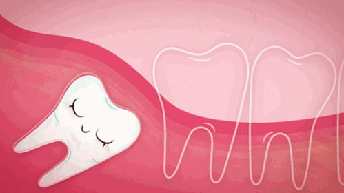 智齿出现这 6 种情况,不管疼不疼都要拔