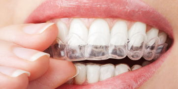 牙齿矫正的具体环节你知道吗 