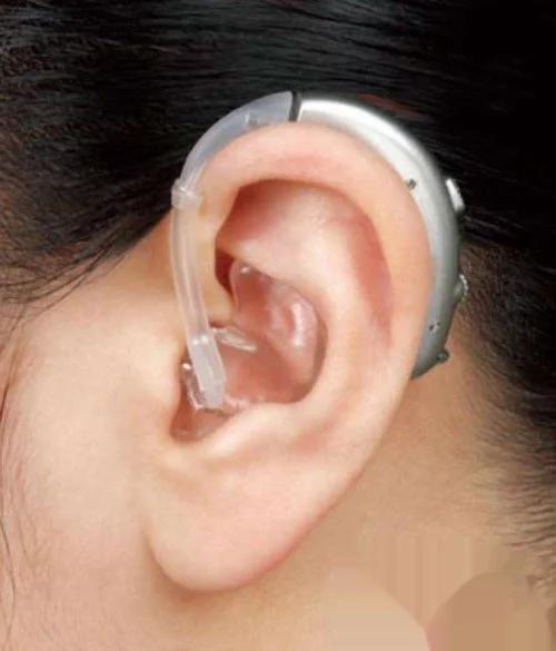 铜梁惠耳助听器连锁中心 助听器什么牌子好