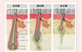 植发多久能长出头发