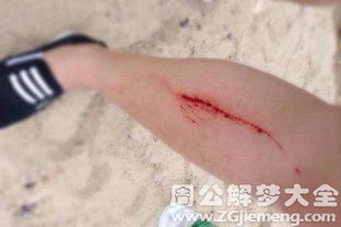 梦见自己大腿流血是什么意思 梦到自己大腿流血好不好 大鱼解梦网 