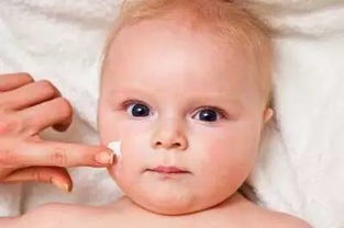 婴儿湿疹最佳治疗方法 