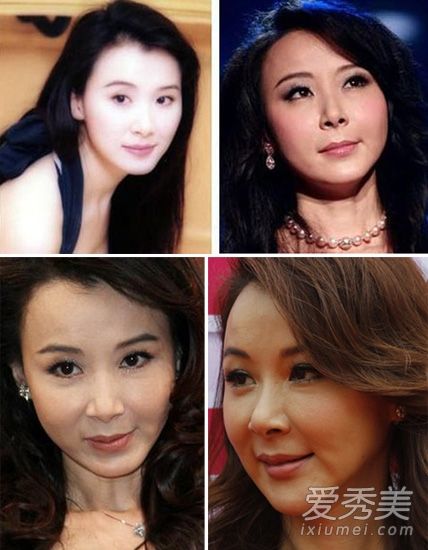 相爱穿梭千年郑爽美丽但颜僵 到底女星整容后遗症容谁更惨