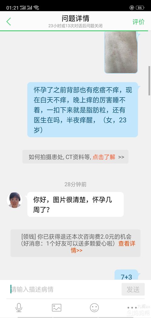 孕初期发痒厉害,很多医生不建议用药,只能忍