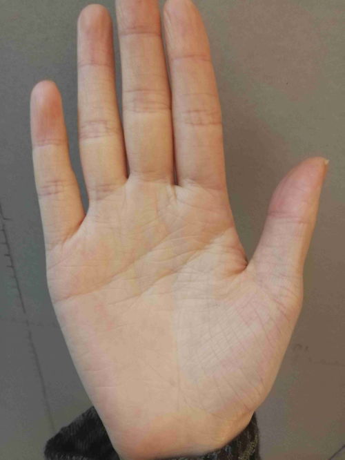 三角在太阳线上手纹,怎么看手相手相的三条线分别代表什么