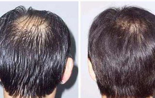 染头发的危害有哪些 男人经常染头发的危害