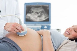 孕妇产前检查(产前检查需要准备什么)