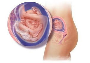 原创胎儿发育过程中会发生的畸形