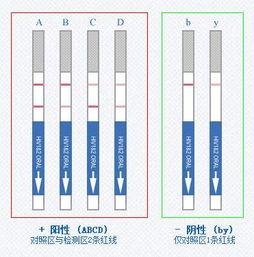 艾滋病检测试纸 搜狗百科 