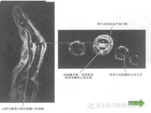 手指的磁共振,你让我彻底凌乱