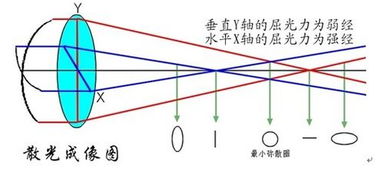 散光能戴隐形吗需要注意些什么(散光能带隐形眼镜吗?)