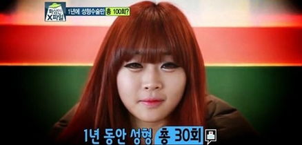 3名韩国女子整容成瘾 1年整容上百次 