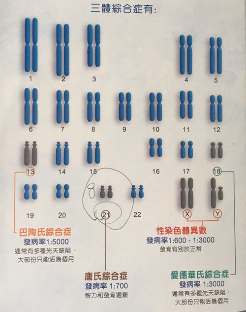 试管婴儿技术是如何预防 唐氏儿 的 你对于唐氏综合症了解多少 