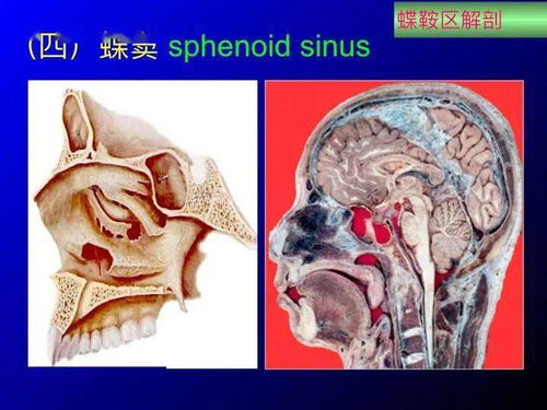 鞍区应用解剖 断层解剖图谱