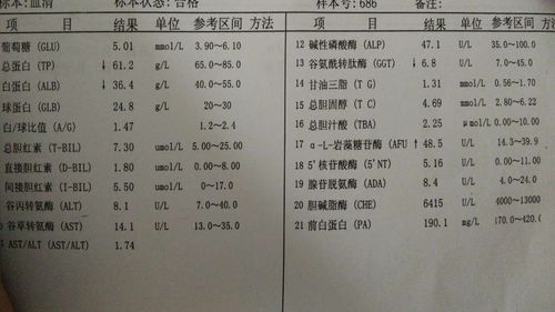 肝功能报告,有没人看得懂的 