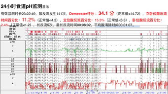 咳嗽哮喘老不好 没想到与胃食管反流病有关系