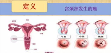 国内罕见！徐州一女子输卵管被切除竟还能怀孕……