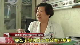 武汉仁爱医院：不用医院也能检测怀孕？这个方法让你震惊不已！