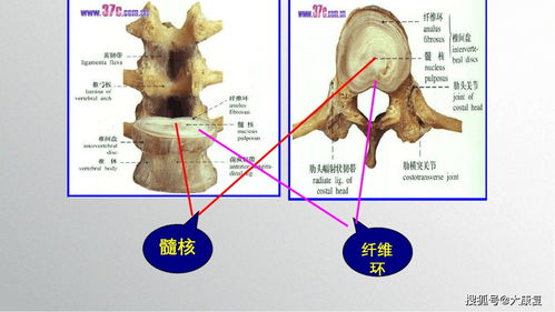 办公室保健 颈椎 腰椎预防 