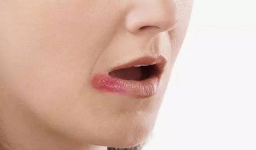 表情 为什么嘴角经常会起泡 多半离不开这些因素 嘴角 梨子 抵抗力 ... 表情 