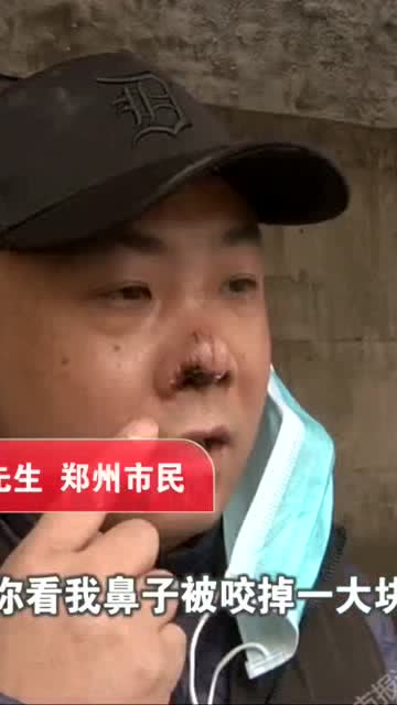 鼻子掉了一块肉 业主 物业经理咬的 物业 摔倒挂牙上了 