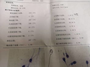 精子正常比例只有1.4多怎么办 