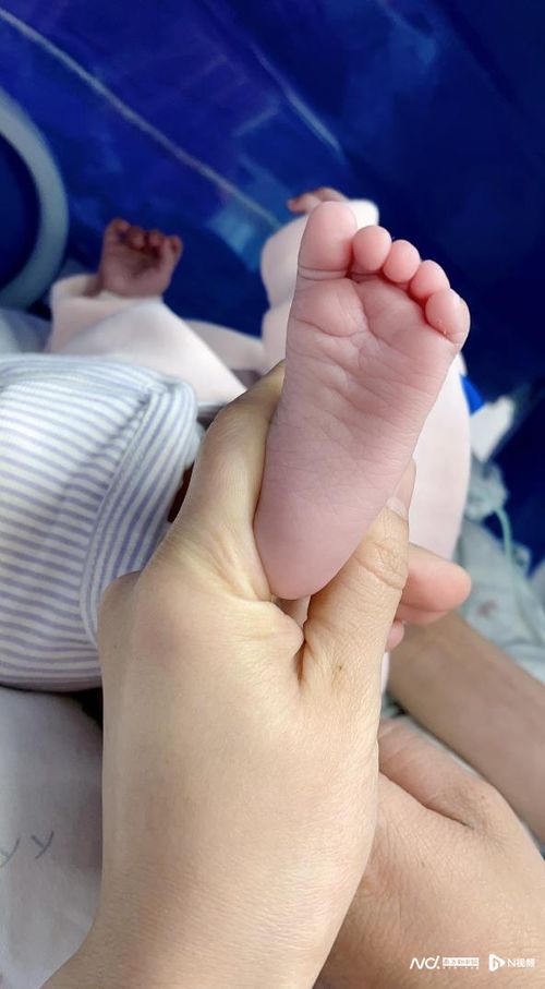 出生体重仅600克，哥伦比亚籍早产宝宝在穗成功获救
