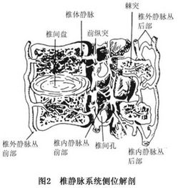 转移性骨肿瘤的鉴别诊断 